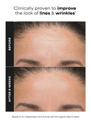 6% Mandelic Acid + 2% Lactic Acid Liquid Exfoliant