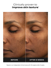 6% Mandelic Acid + 2% Lactic Acid Liquid Exfoliant